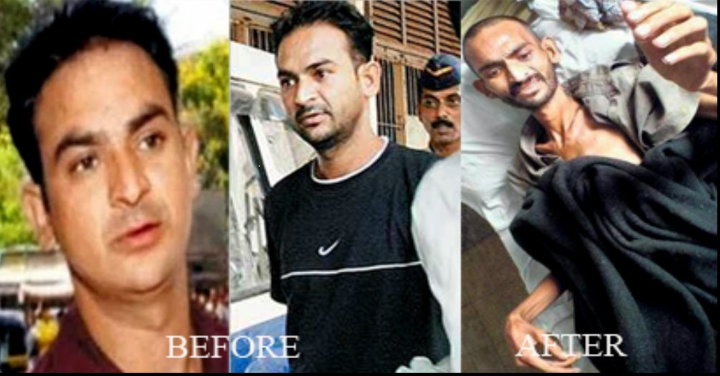 Ravindra Patil Before and after pictures