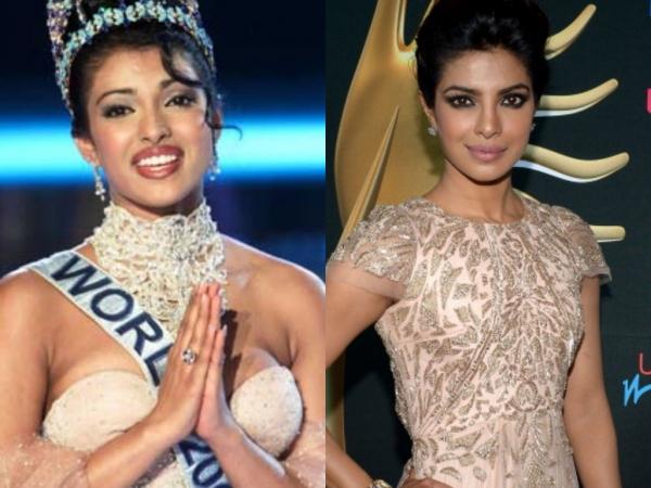 Bollywood Beauties and their Plastic Surgeries
