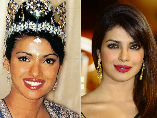 Bollywood Actresses Lip Jobs that didn't impress us at all