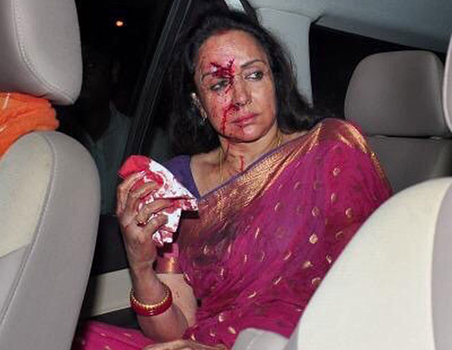 Bollywood celebrities who escaped near death - Bollywood Bubble