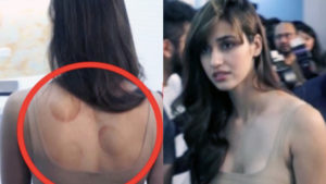 Disha Patani clicked with cupping bruises at an event!