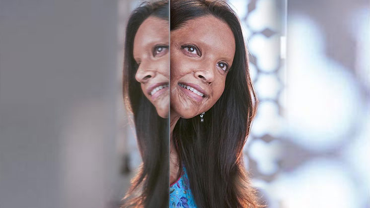 Deepika Padukone Chhapaak Trailer