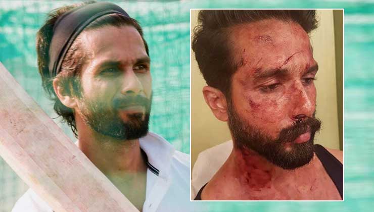 shahid kapoor jersey set injured 13 stitches