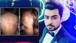'Bigg Boss 8' fame Pritam Singh brutally beaten up by goons for rescuing a couple