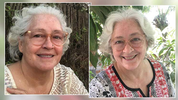 Nafisa Ali leucoderma