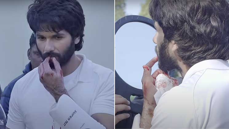 Shahid Kapoor, jersey, shahid kapoor injured