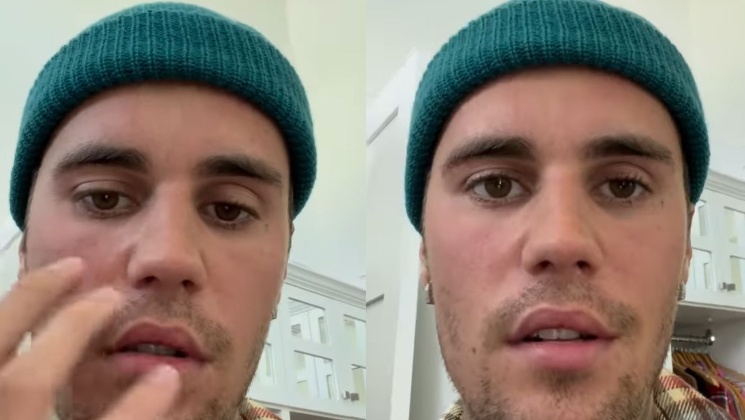 justin bieber, justin bieber instagram, justin bieber paralysis,