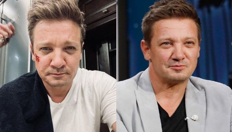Jeremy Renner shares first pic from hospital after undergoing surgery, informs fans, 'I am too messed up now to type'