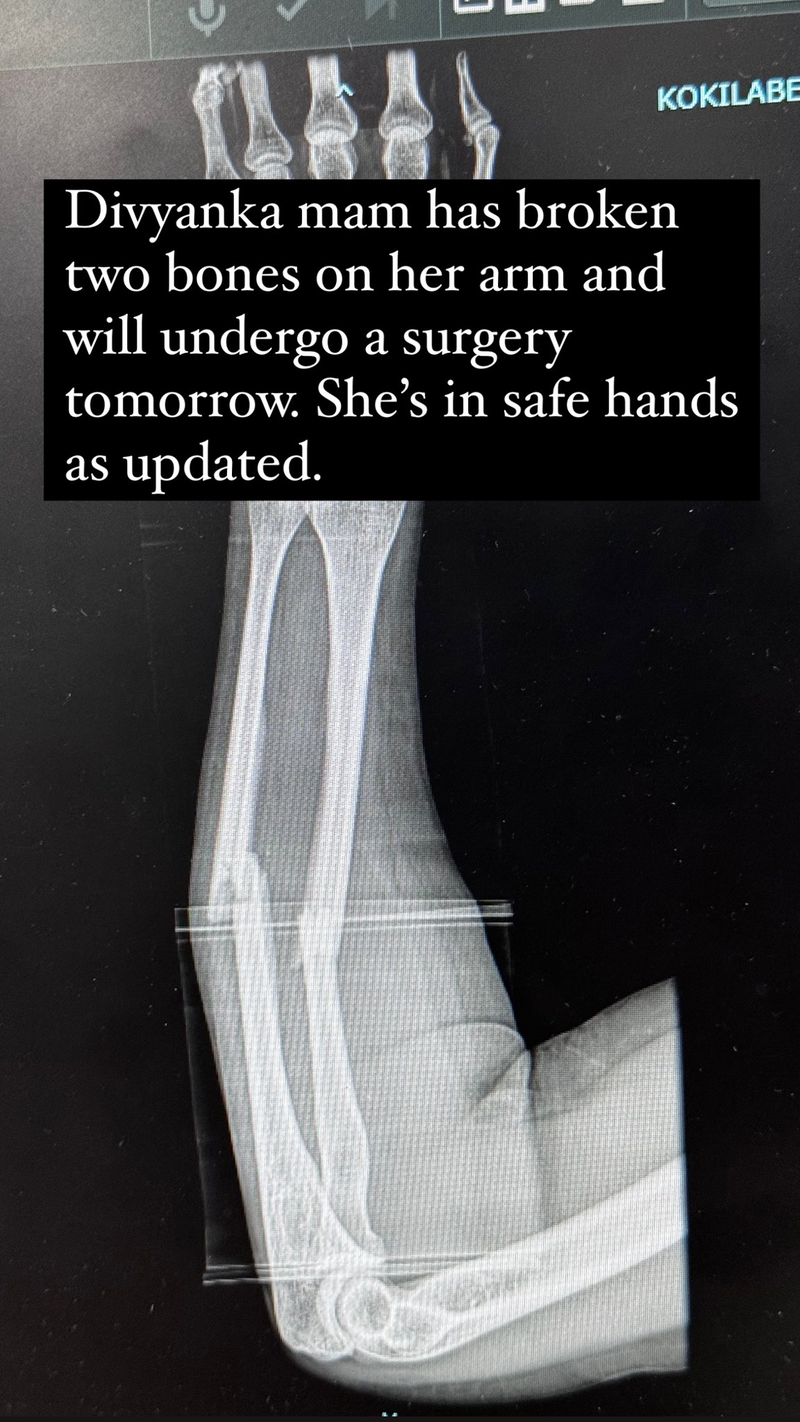 Vivek Dahiya informs fans about Divyanka's accident