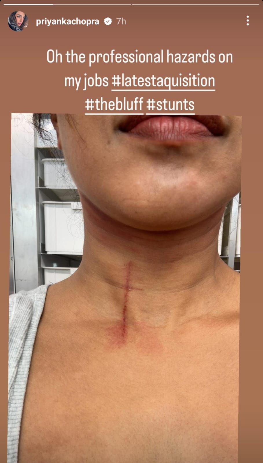 Priyanka Chopra injured on the sets of The Bluff