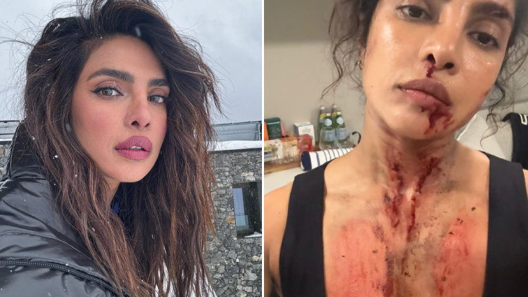 priyanka chopra, priyanka chopra injuries, the bluff