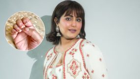 Hina Khan on her nails discolouration