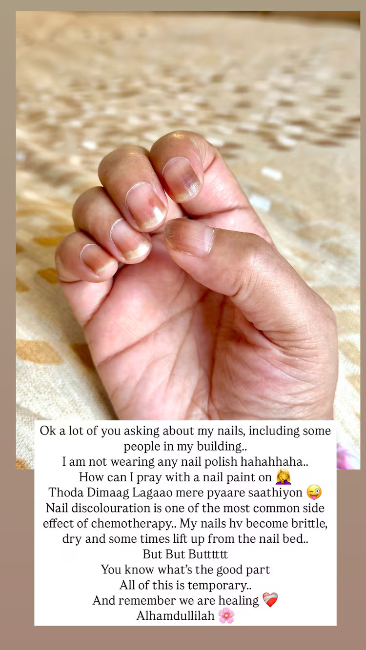Hina Khan on her nails discolouration