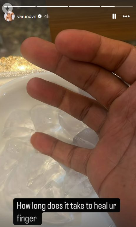 Varun Dhawan Shares Injured Finger Picture