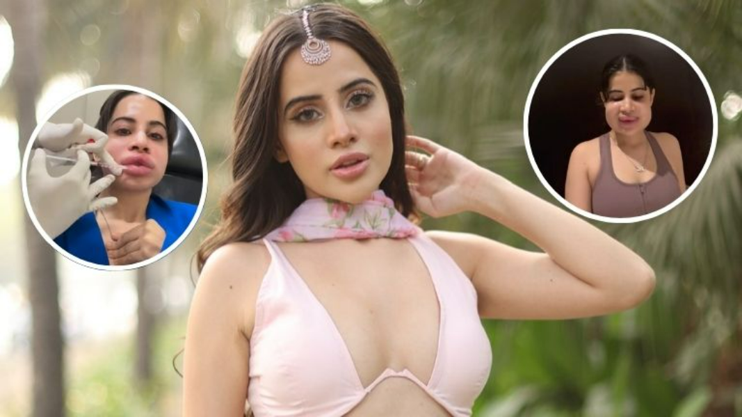 Uorfi Javed Drops Swollen Face Video