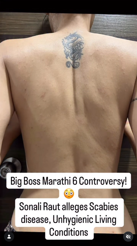 Sonali Raut Shares Visuals Highlighting The Impact On Her Health