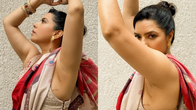 Rajshri Deshpande Embraces Breast Cancer Scars, Calls Them The 'Story Of My Survival'